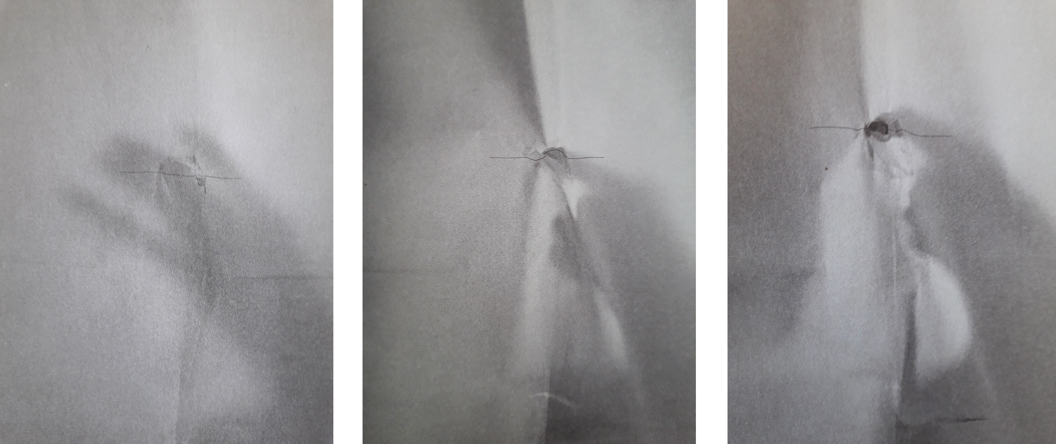 Image/photo
